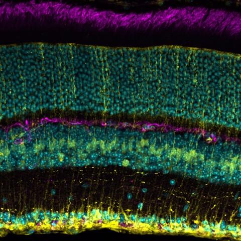 A microscope image of a mouse retina